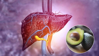 Los beneficios de consumir aguacate todos los días para combatir el hígado graso