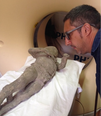 Los restos humanos muestran túnicas