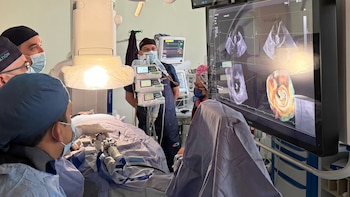 El Instituto Nacional de Cardiología hace historia con nuevo procedimiento “sin abrir el pecho” para tratar la insuficiencia mitral