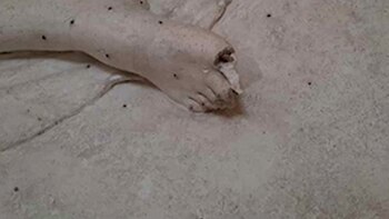 El detalle del pie roto