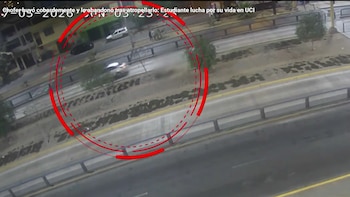 Estudiante de 22 años permanece en UCI tras ser atropellado por auto que invadió vía del Metropolitano y huyó en Comas