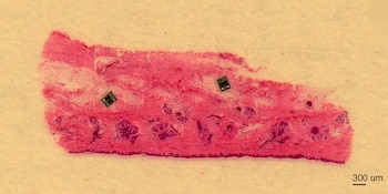 Estos dispositivos, del tamaño de