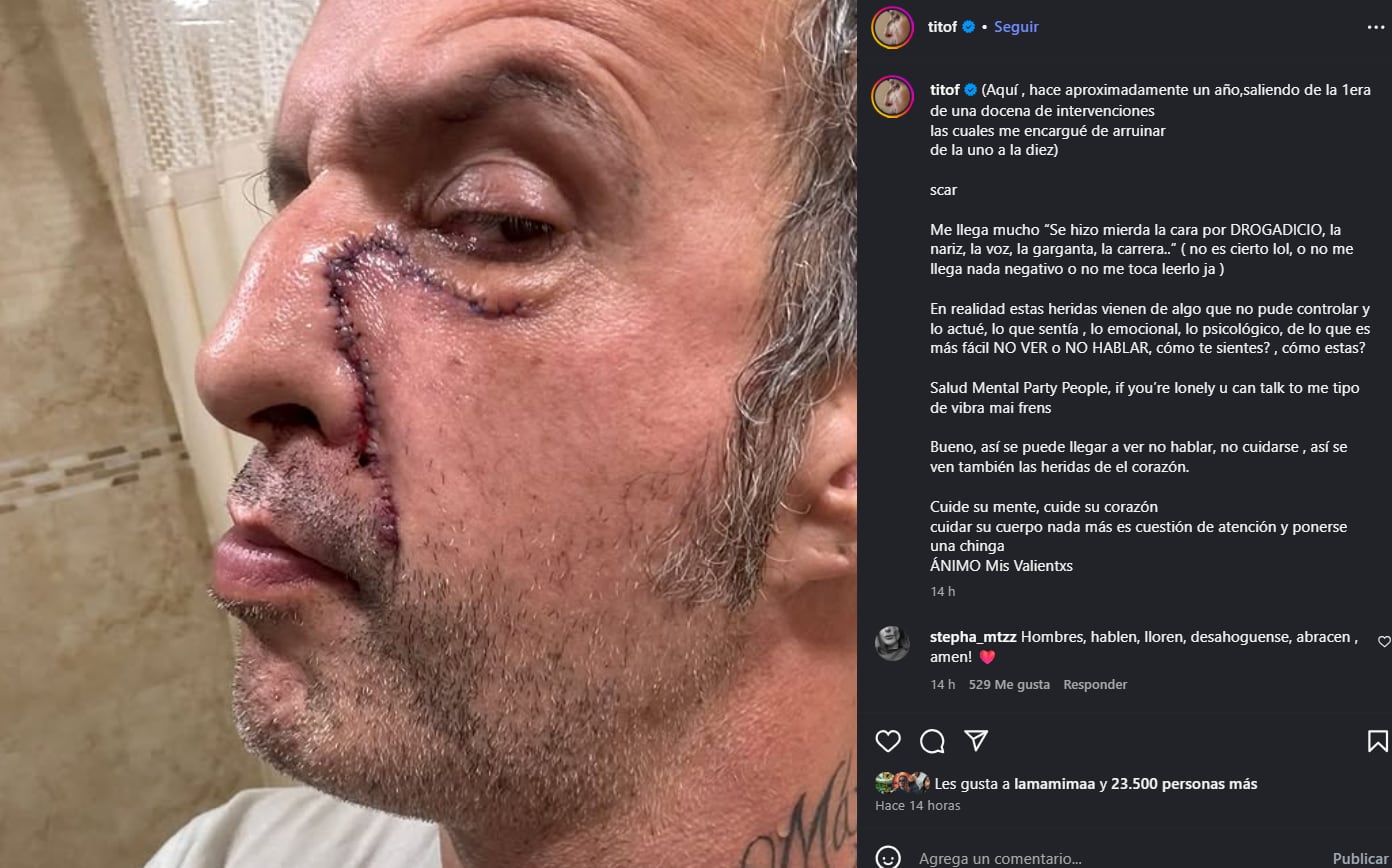 Tito Fuentes sobre su salud. (Instagram: titof)