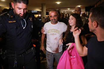 El pasajero israelí Yaniv Hayoun, con manchas de sangre en la camisa, es recibido en la terminal del aeropuerto Ben Gurion, cerca de Tel Aviv. Dijo que tiró de los controles hasta que el avión empezó a nivelarse (AP Foto/Tomer Appelbaum)