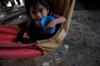 Yesmin Anayeli, una niña de 22 meses diagnosticada con desnutrición severa en La Ceiba, Guatemala, el 9 de octubre de 2020 (REUTERS/Josué Decavele)