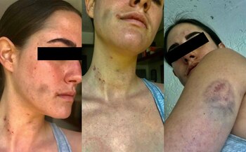 De acuerdo a Adela Micha,