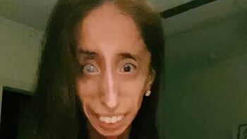Lizzie Velasquez pidió que el