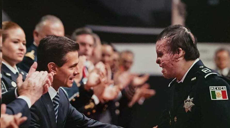 El exagente fue condecorado por Enrique Peña Nieto tras sufrir quemaduras en el 70% de su cuerpo y someterse a 15 cirugías. (Captura de pantalla/Univisión)
