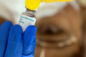 La viruela símica o Mpox