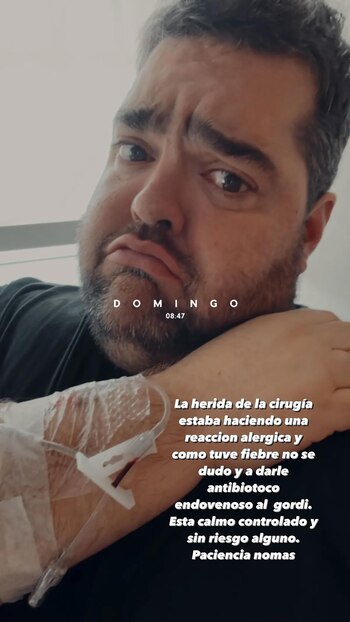 Darío Barassi debió ser nuevamente