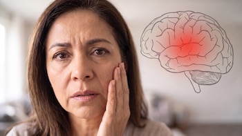 Hormigueo en un lado de la cara, brazo o pierna: cuándo podría tratarse de un derrame cerebral