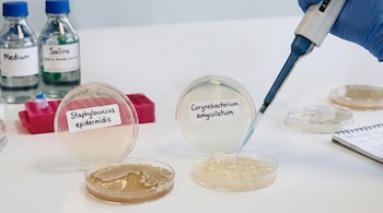 Mano con guante azul y pipeta, varias placas de Petri con cultivos bacterianos y sus etiquetas, botellas de laboratorio con líquidos y un cuaderno.