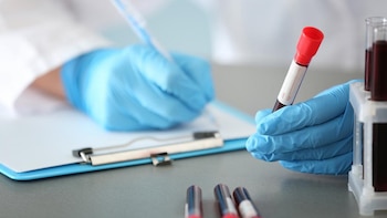 Un simple análisis de sangre puede ayudar a detectar y estadiar la enfermedad de Alzheimer