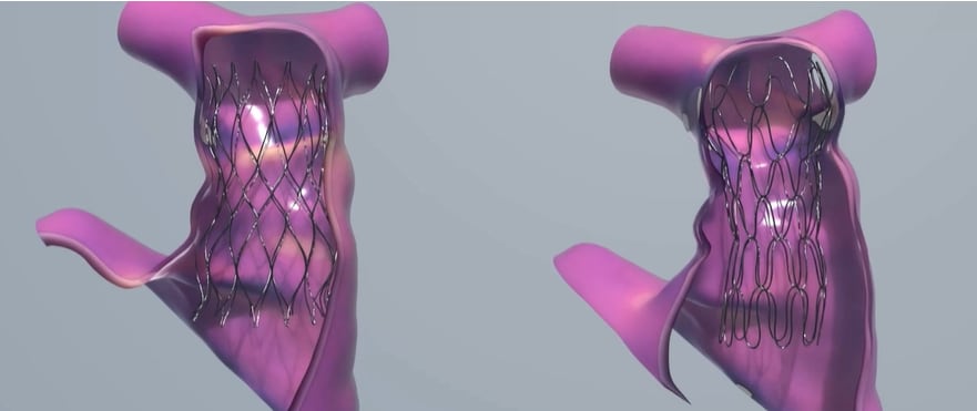 Esta tecnología ayuda a los médicos a preparar intervenciones más seguras y ajustadas a las características de cada paciente. (Nvidia)