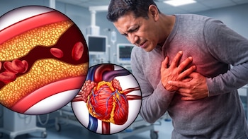 Enfermedades cardiovasculares concentran 39% de las muertes en El Salvador