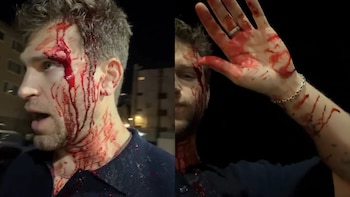 Keegan Allen, actor de Pretty Little Liars, sufrió un robo a punta de pistola y cuchillo en California: “Mi vida por un reloj”