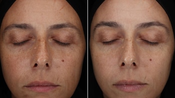 La Roche Posay para uso de Inhouse