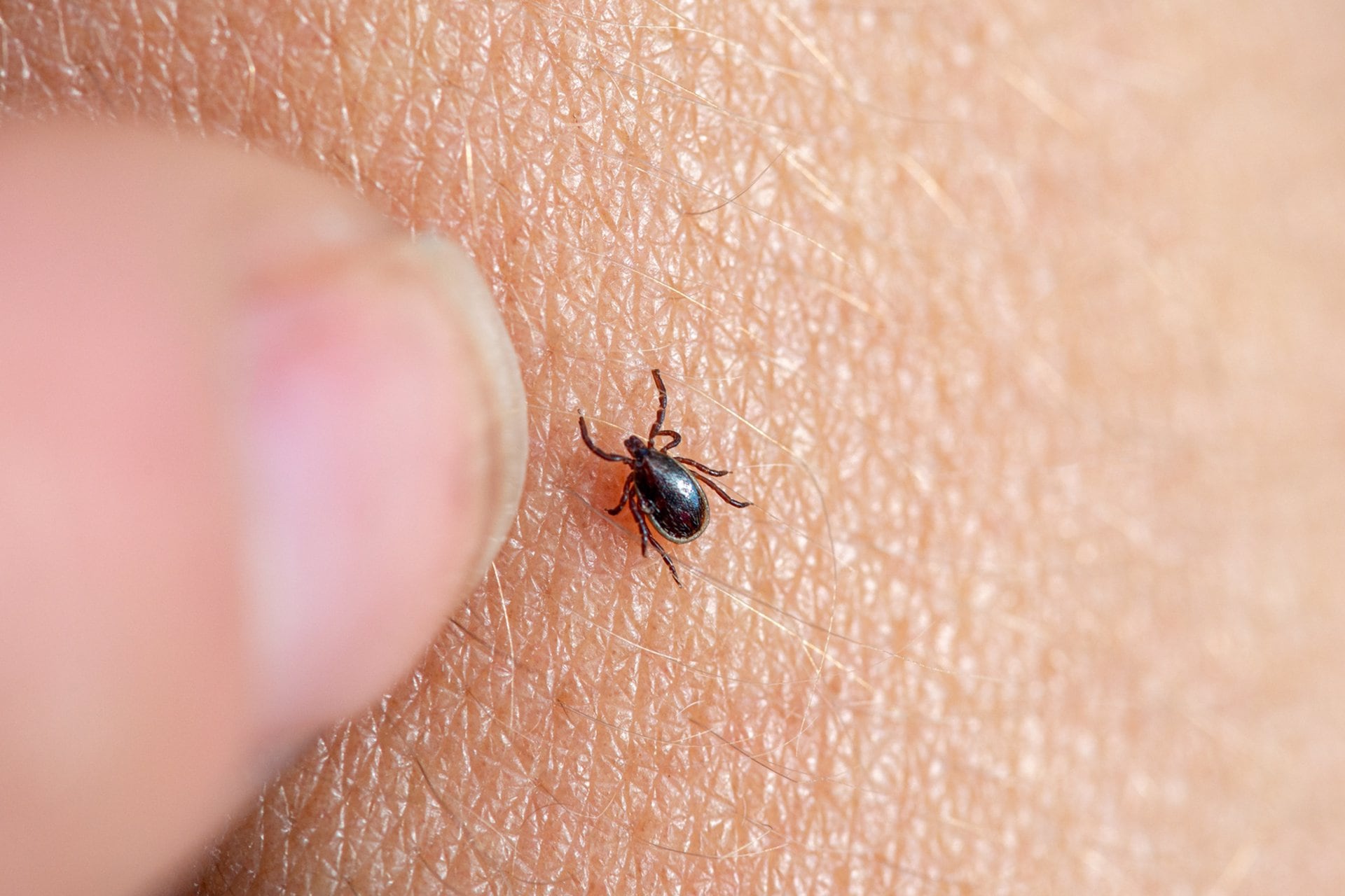 La enfermedad de Lyme, transmitida por la picadura de ciertas garrapatas, requiere atención médica temprana para evitar secuelas a largo plazo, según advierte la Cleveland Clinic (Fundación SOS LYME)