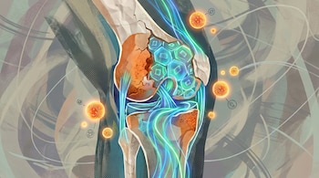 Corte transversal de una rodilla humana con cartílago dañado. Células brillantes y flujos de energía azul y verde conectan el tejido, junto a esferas flotantes.