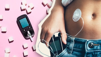 Desarrollaron un páncreas artificial que