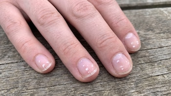 Manchas blancas en las uñas: qué pueden indicar y cuándo consultar