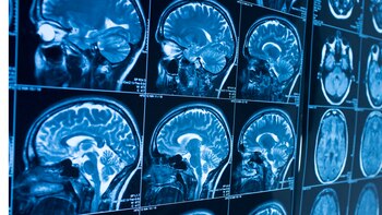 “Es algo real, aunque