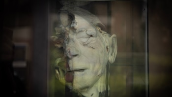El “hombre de dos cabezas” y otras historias impactantes detrás de las piezas del Museo del Cerebro de Lima, único en Latinoamérica