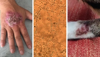 La infección por Sporothrix brasiliensis