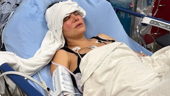 Qué es la preeclampsia, padecimiento