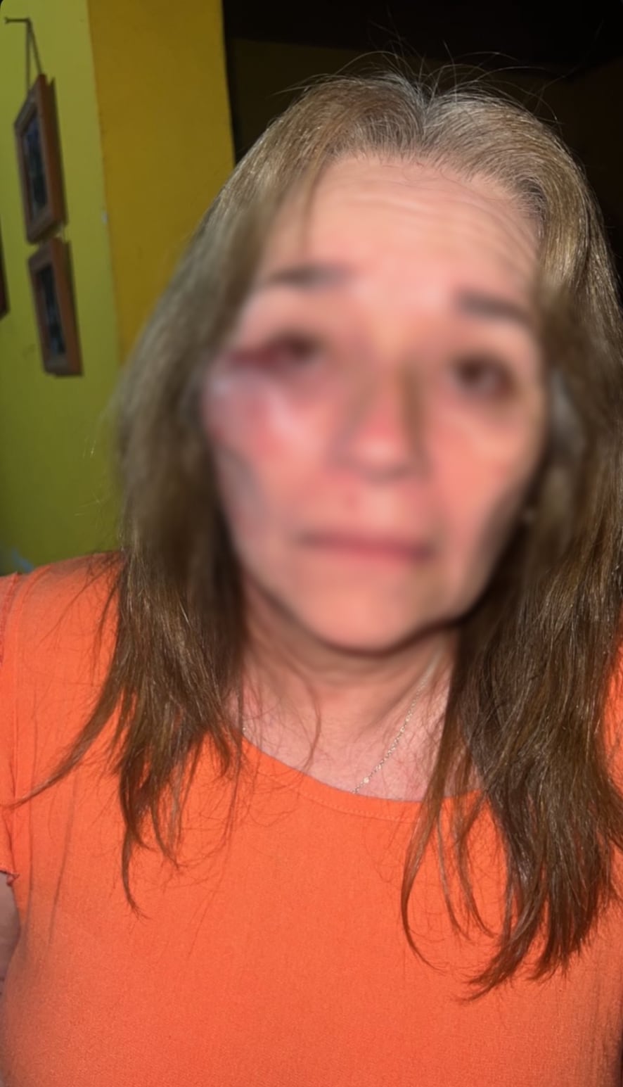La suegra del presunto agresor fue golpeada salvajemente