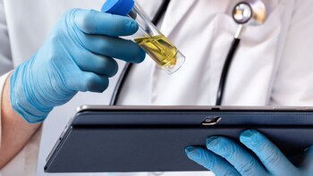 Una prueba de orina podría