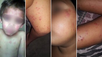 Los efectos de los agroquímicos