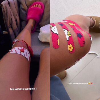 Karol G se recupera rápidamente