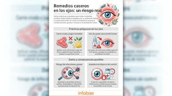 Infografía que ilustra los riesgos de remedios caseros para los ojos, mostrando un ojo irritado, carne cruda, limón, gotas para los ojos y un ojo afectado por bacterias.