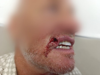 La lesión al dueño del