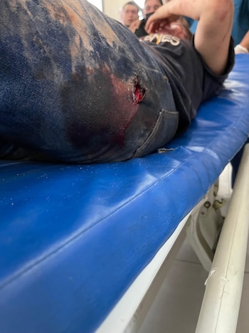 Seis muertos y nueve heridos tras el choque de una volqueta en la colonia Villa Nueva de Tegucigalpa, Honduras.