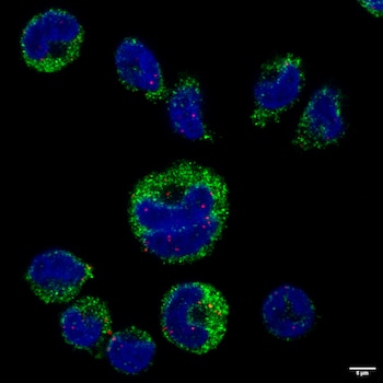 El parásito de la malaria