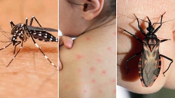 Reconocer las diferencias entre estos