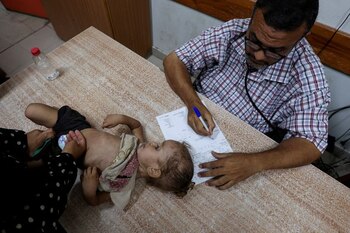 FOTO DE ARCHIVO: Una niña palestina es examinada por un médico en el Hospital de los Mártires de Al-Aqsa, en Deir Al-Balah, en el centro de la Franja de Gaza (REUTERS/Ramadan Abed/Fotografía de archivo)