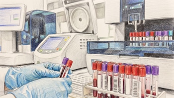 Un análisis de sangre podría detectar el cáncer de hígado en etapas tempranas: así funciona con ayuda de IA