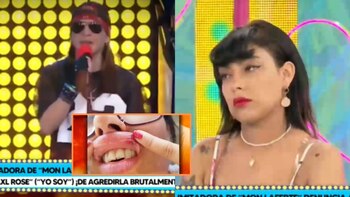 Escándalo en el espectáculo: Imitadora