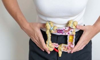 La enfermedad de Crohn es