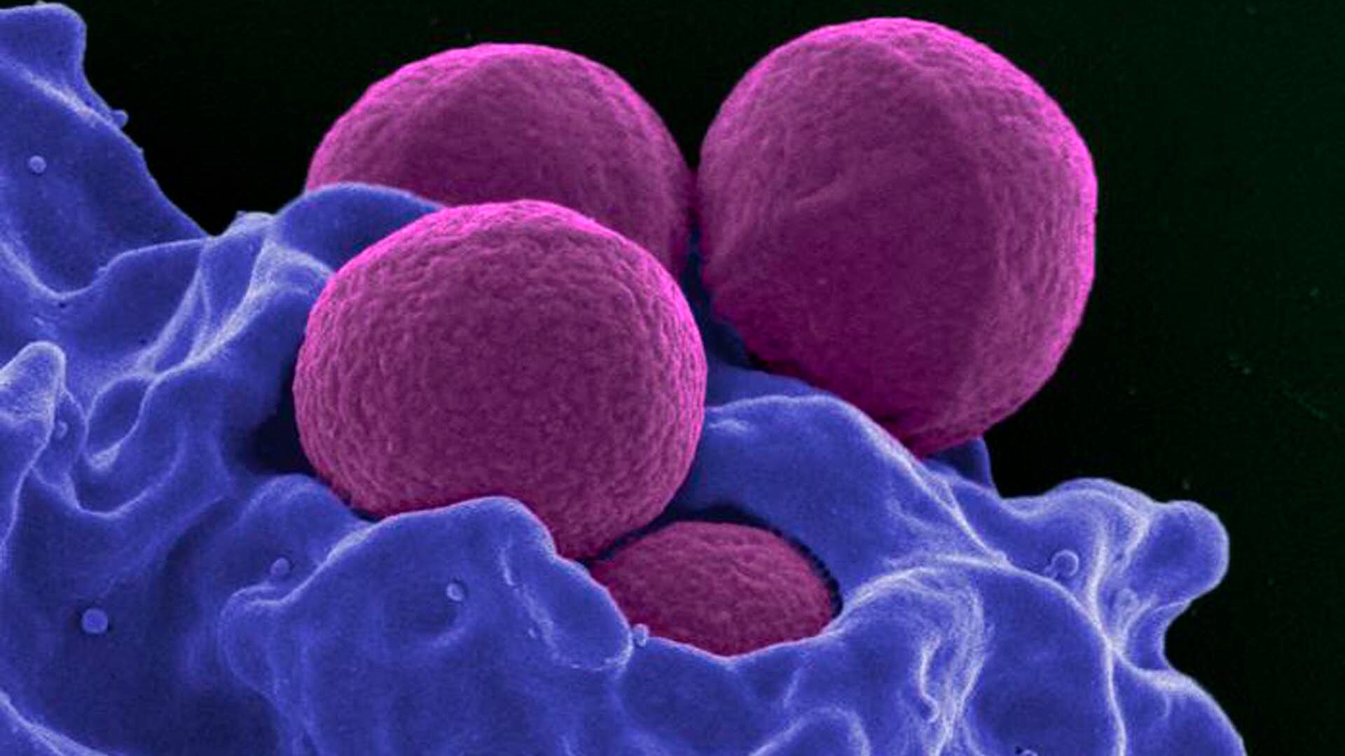 El nuevo antibiótico pre-metilenomicina C lactona demostró, en pruebas de laboratorio, poder eliminar bacterias MRSA, que son resistentes a los antibióticos tradicionales (National Institute of Allergy and Infectious Diseases)