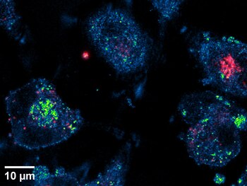 La formación de middosomas (mostrados