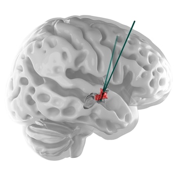 Una representación visual de la