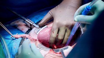 (Joe Carrotta/NYU Langone Health via