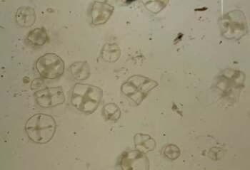 Investigadoras del INIBIOMA y la