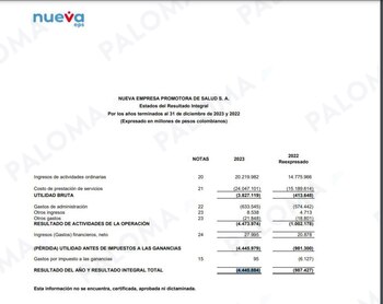 Las pérdidas de la Nueva