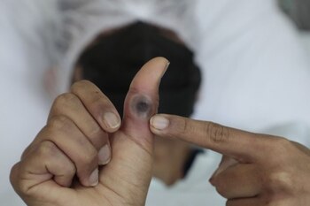 Minsa emitió una serie de