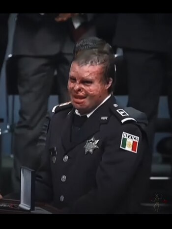 Su historia de supervivencia fue